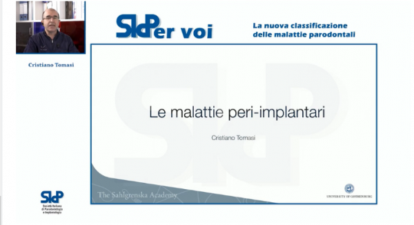 Le malattie peri-implantari